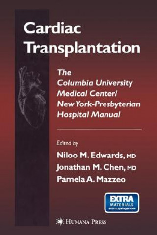 Kniha Cardiac Transplantation Niloo M. Edwards