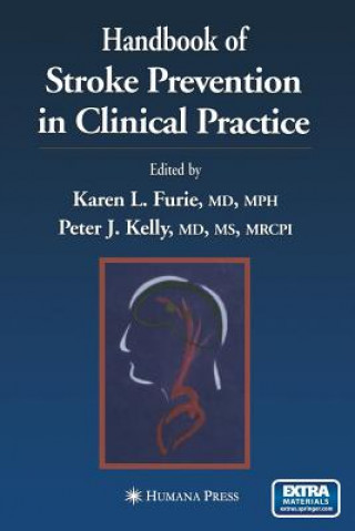 Kniha Handbook of Stroke Prevention in Clinical Practice Karen L. Furie