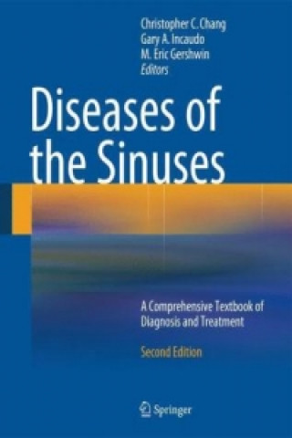 Kniha Diseases of the Sinuses Christopher C. Chang