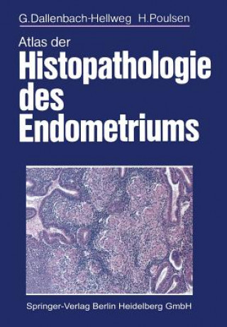 Carte Atlas Der Histopathologie Des Endometriums G. Dallenbach-Hellweg