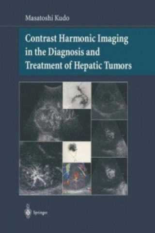 Kniha Contrast Harmonic Imaging in the Diagnosis and Treatment of Hepatic Tumors Masatoshi Kudo