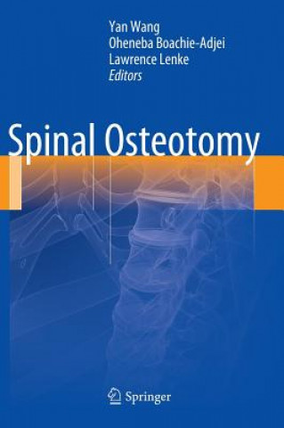 Livro Spinal Osteotomy Yan Wang