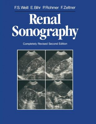 Kniha Renal Sonography Francis S. Weill