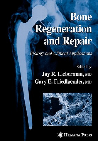 Knjiga Bone Regeneration and Repair Jay R. Lieberman