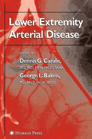 Książka Lower Extremity Arterial Disease Dennis G. Caralis