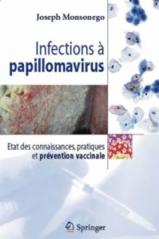 Knjiga Infections Joseph Monsonego
