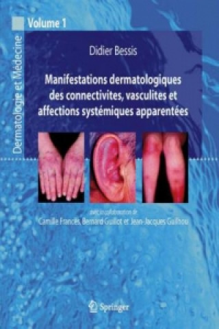 Книга Manifestations dermatologiques des connectivites, vasculites et affections systémiques apparentées Didier Bessis