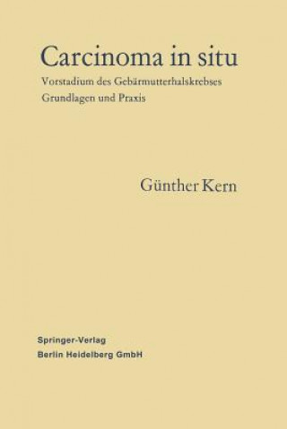Kniha Carcinoma in Situ Günther Kern