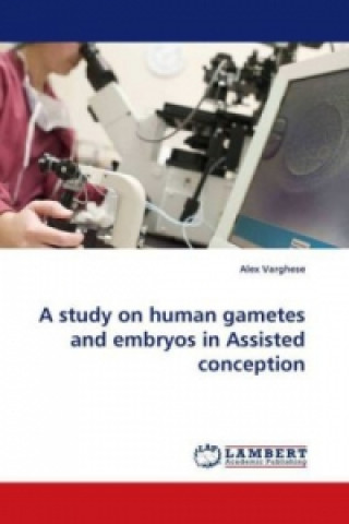 Carte A study on human gametes and embryos in Assisted conception Alex Varghese