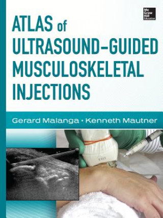 Carte Atlas of Ultrasound-Guided Musculoskeletal Injections Gerard Malanga
