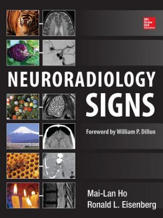 Könyv Neuroradiology Signs Mai-Lan Ho