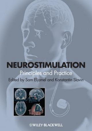 Carte Neurostimulation - Principles and Practice Sam Eljamel