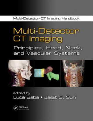 Kniha Multi-Detector CT Imaging Luca Saba