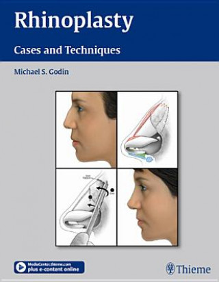 Buch Rhinoplasty - Cases and Techniques Michael Godin