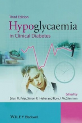 Carte Hypoglycaemia in Clinical Diabetes 3e Brian M. Frier