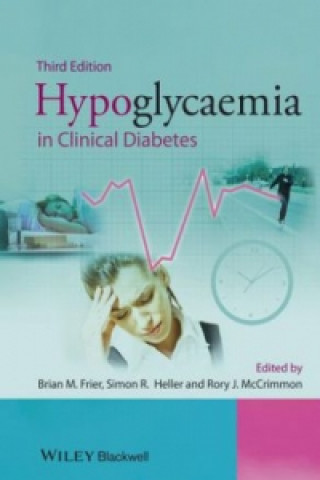 Kniha Hypoglycaemia in Clinical Diabetes 3e Brian M. Frier