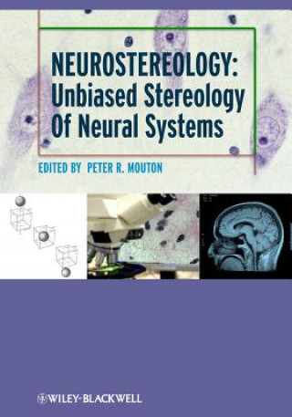 Kniha Neurostereology - Unbiased Stereology of Neural Systems P. R. Mouton