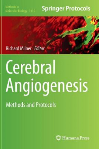 Carte Cerebral Angiogenesis Richard Milner