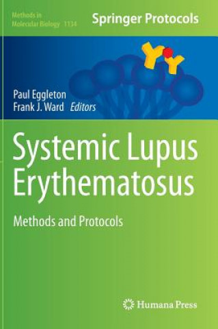 Könyv Systemic Lupus Erythematosus Paul Eggleton