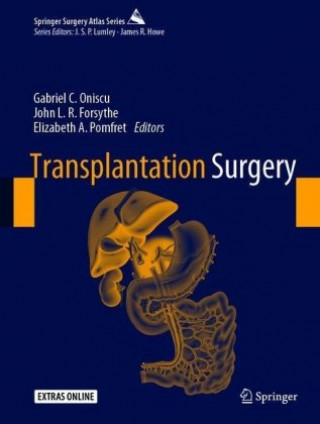 Könyv Transplantation Surgery Nadey S. Hakim