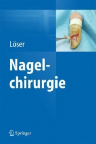 Kniha Nagelchirurgie Christoph Löser