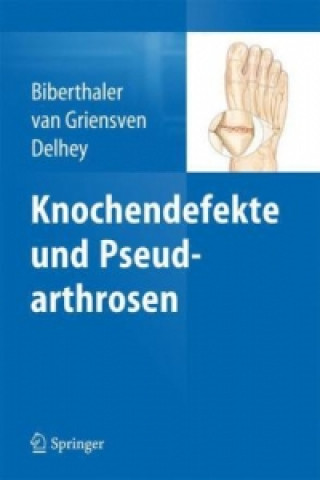 Könyv Knochendefekte und Pseudarthrosen Peter Biberthaler