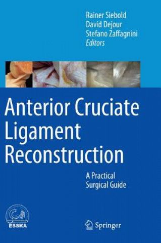 Könyv Anterior Cruciate Ligament Reconstruction Rainer Siebold