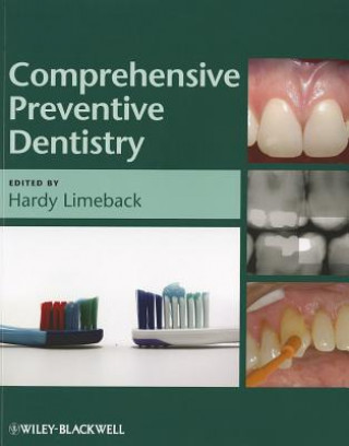 Kniha Comprehensive Preventive Dentistry Hardy Limeback