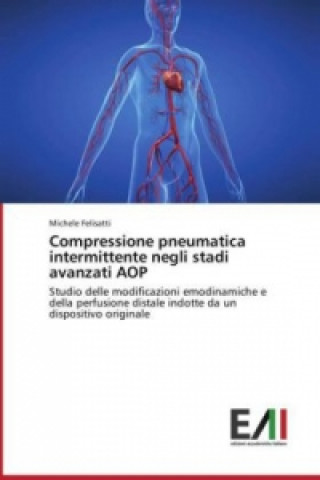 Книга Compressione pneumatica intermittente negli stadi avanzati AOP Michele Felisatti