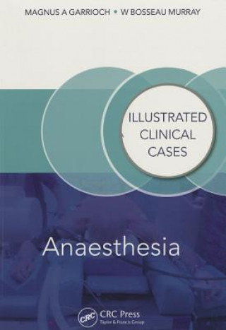 Könyv Anaesthesia Magnus Garrioch & Bosseau Murray