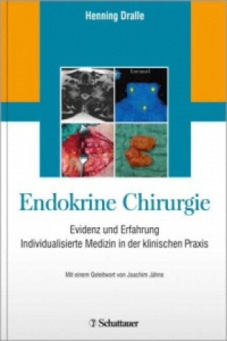 Książka Endokrine Chirurgie Henning Dralle
