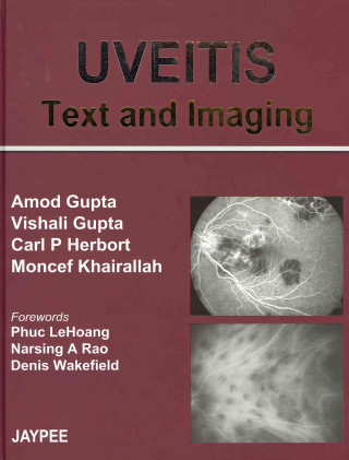 Carte UVEITIS Text and Imaging Amod Gupta