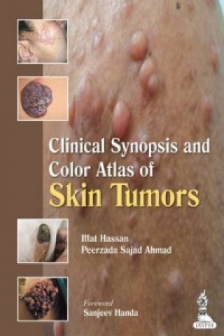 Könyv Clinical Synopsis and Color Atlas of Skin Tumors Iffat Hassan