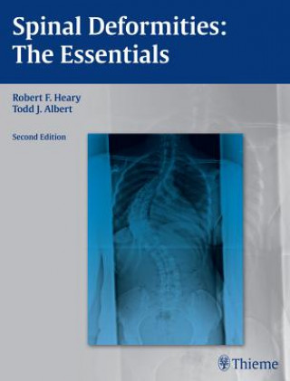 Książka Spinal Deformities Robert F. Heary