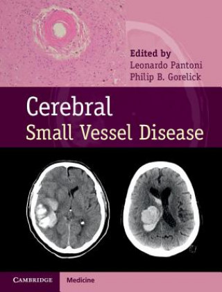 Книга Cerebral Small Vessel Disease Leonardo Pantoni