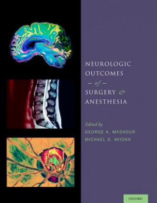 Knjiga Neurologic Outcomes of Surgery and Anesthesia George A Mashour