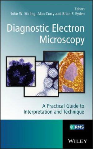 Kniha Diagnostic Electron Microscopy - A Practical Guide  to Interpretation and Technique John Stirling