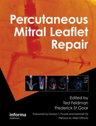 Könyv Percutaneous Mitral Leaflet Repair Ted Feldman