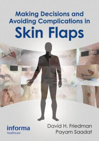 Könyv Making Decisions and Avoiding Complications in Skin Flaps David H Friedman
