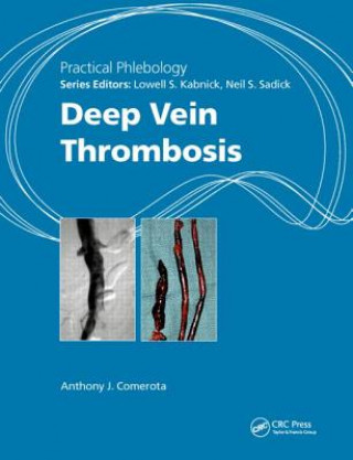 Knjiga Practical Phlebology Anthony J Comerota