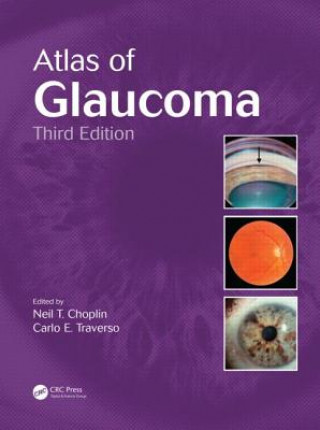 Könyv Atlas of Glaucoma Neil T Choplin & Carlo E Traverso