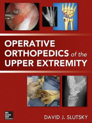 Книга Operative Orthopedics of the Upper Extremity David Slutsky