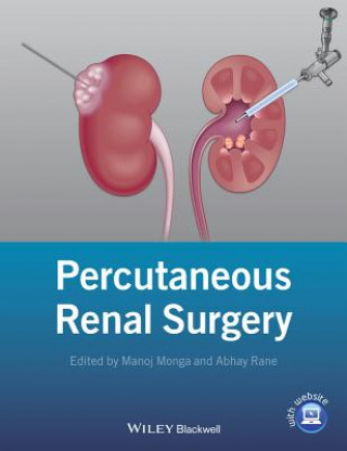 Carte Percutaneous Renal Surgery Manoj Monga
