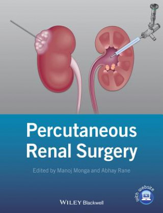 Knjiga Percutaneous Renal Surgery Manoj Monga