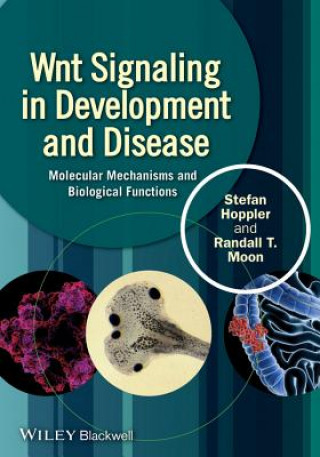 Buch Wnt Signaling in Development and Disease - Molecular Mechanisms and Biological Functions Stefan P. Hoppler