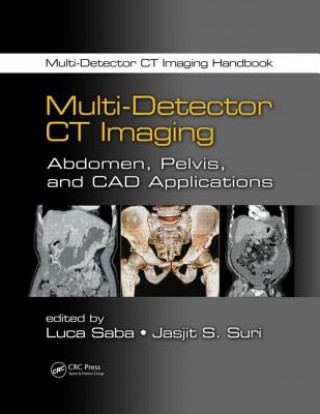 Kniha Multi-Detector CT Imaging Luca Saba