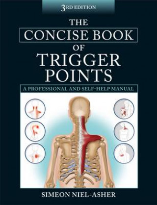 Książka Concise Book of Trigger Points Simeon Neil-Asher
