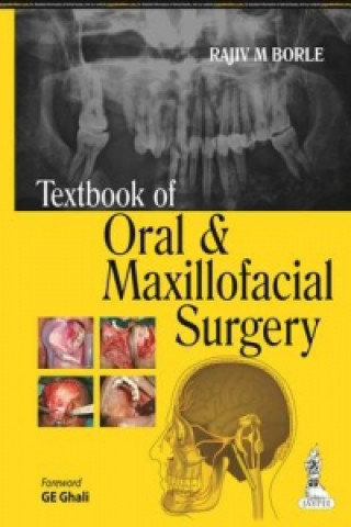 Buch Textbook of Oral and Maxillofacial Surgery Rajiv M Borle