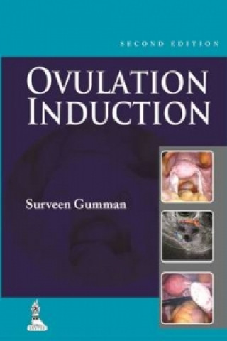 Książka Ovulation Induction Surveen Ghumman