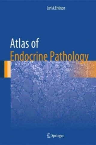 Kniha Atlas of Endocrine Pathology Lori A. Erickson